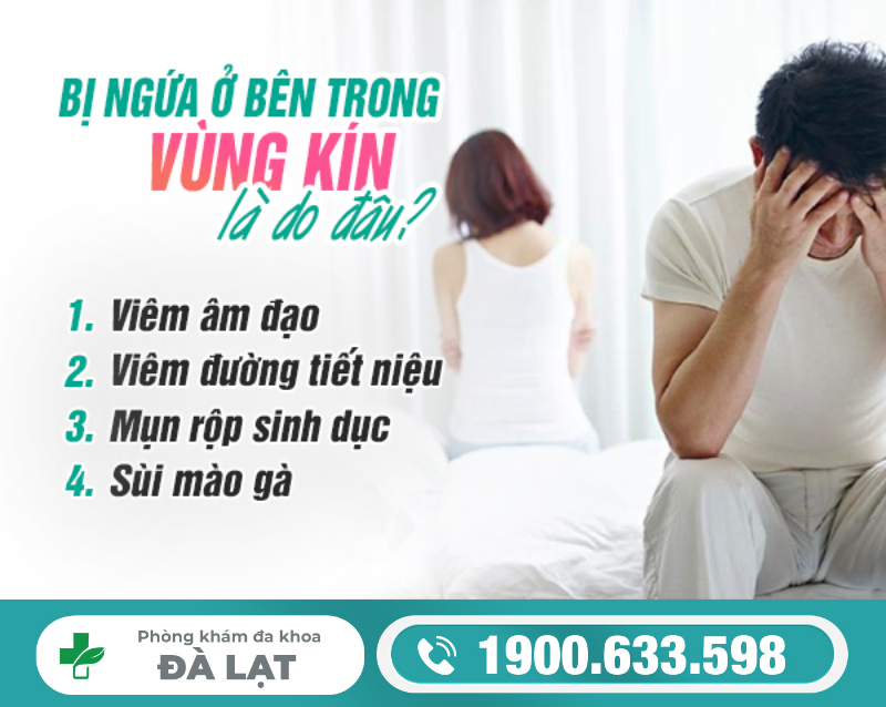 Hình ảnh minh họa